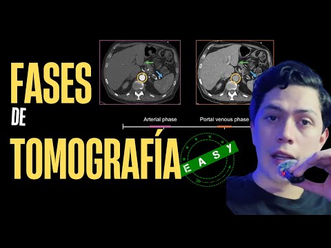 FASES DE TOMOGRAFÍA COMO NUNCA TE LAS HABÍAN EXPLICADO
