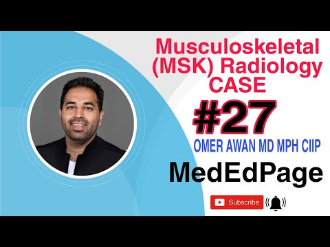 Musculoskeletal (MSK) Radiology CASE #27