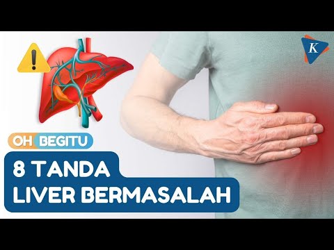 8 Signs of Liver Problems That Need to be Watched Out For, What Are They?