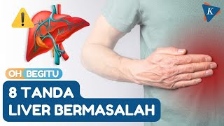 Download lagu 8 Signs of Liver Problems That Need to be Watched Out For, What Are They? mp3