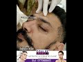 Pollywood Actor Kuljinder Sidhu Testimonial Sclulpt Clinic Best Skin Clinic In India