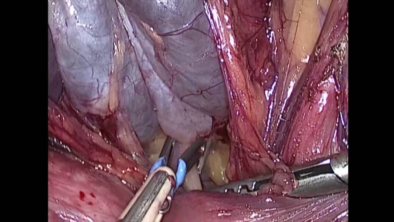 Henry Octavio Rodríguez Daza-11