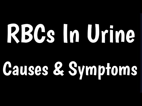 RBCs In Urine | Causes & Symptoms Of Red Blood Cells In Urine |