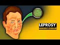 Leprosy (Hansen's disease): Everything You Need to Know