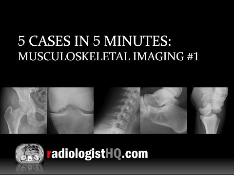5 Cases in 5 Minutes: Musculoskeletal #1