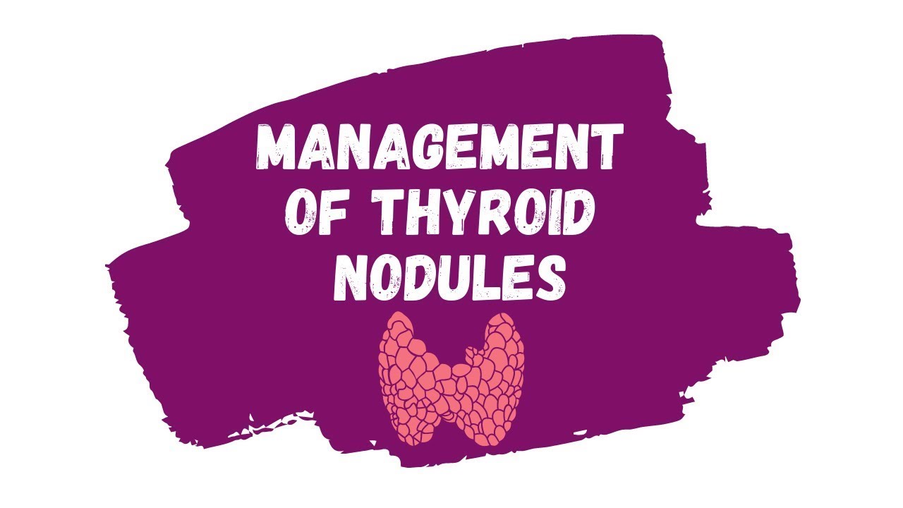 Management of Thyroid Nodules | ALGORITHM