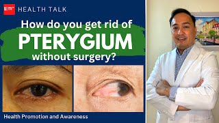 How do you get rid of Pterygium (Pugita) without Surgery?