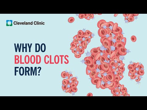 Why Do Blood Clots Form?