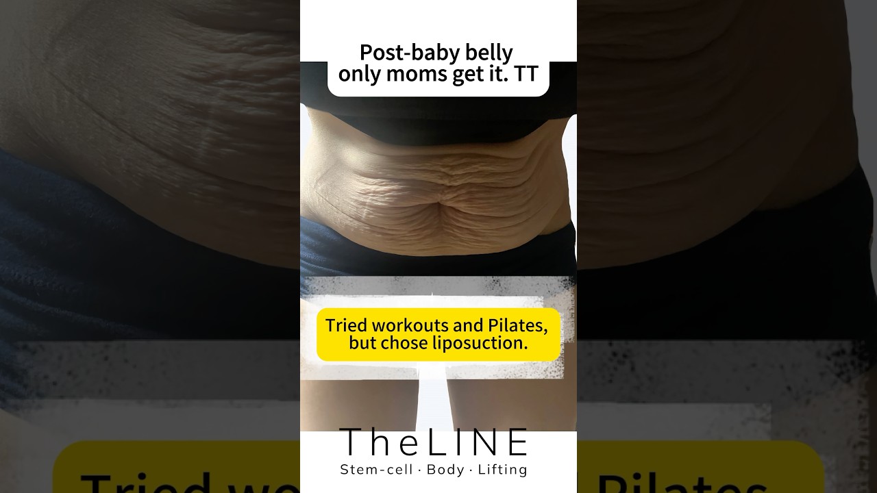 TheLINE shorts video