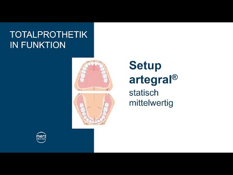 TiF Setup mit dem artegral® - statisch, mittelwertig