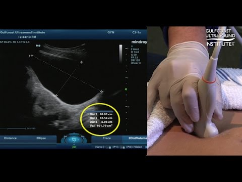 Prostata-Massage zu Hause Tver Schmerz und Prostatitis Steißbein