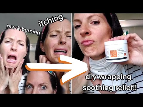 Do THIS for Eczema Relief!