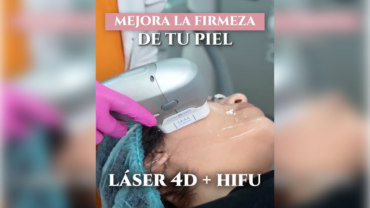 ✨𝗗𝗶𝗹𝗲 𝗮𝗱𝗶𝗼́𝘀 𝗮 𝗹𝗮 𝗳𝗹𝗮𝗰𝗶𝗱𝗲𝘇 𝗳𝗮𝗰𝗶𝗮𝗹 𝗰𝗼𝗻 𝗟𝗮́𝘀𝗲𝗿 𝟰𝗗 + 𝗛𝗜𝗙𝗨💆🏼‍♀️⚡️- Dra. Gisela Pilar Aire Farfán