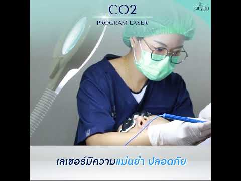 ปรับผิวหน้าให้เรียบเนียน ด้วยโปรแกรม CO2 Laser ที่ นารดาคลินิก