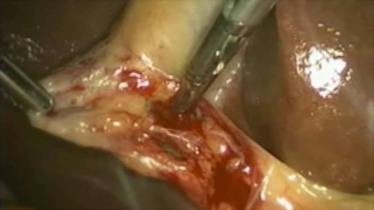 Olliver Núñez Cantú-14