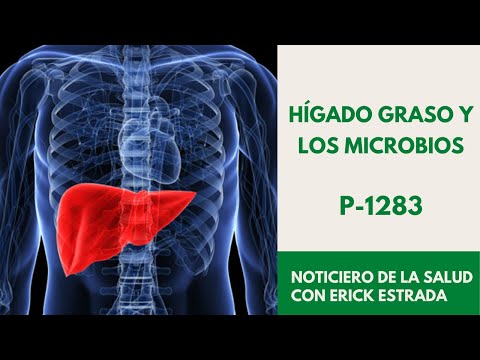 P-1283 Hígado graso y los microbios