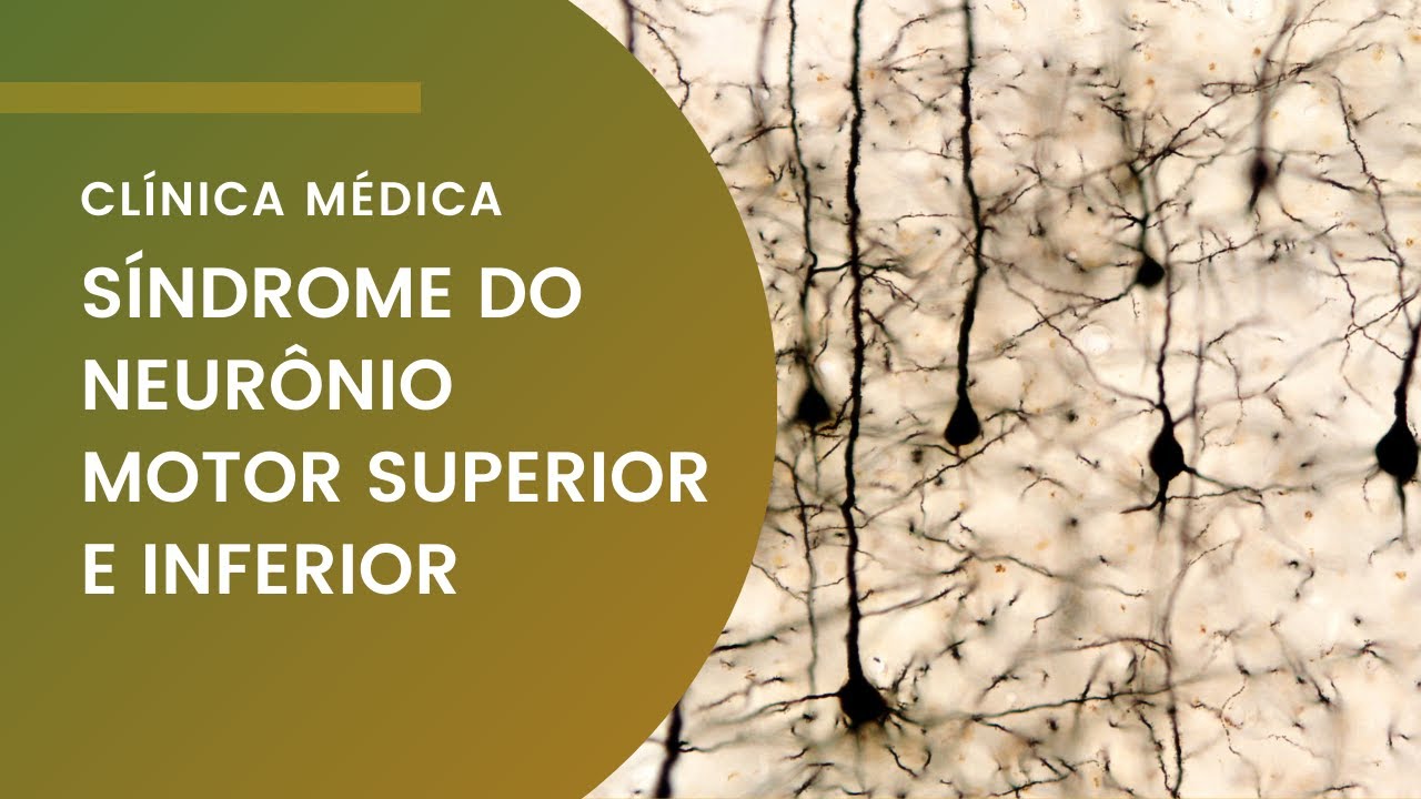 Síndrome do Neurônio Motor Superior e Inferior