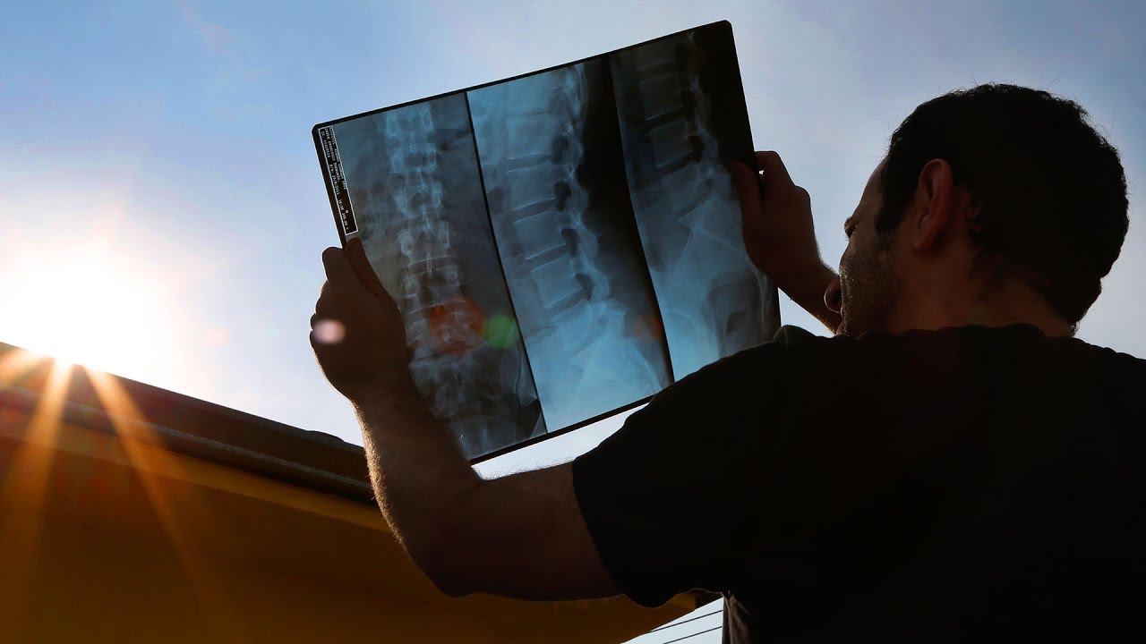 9 Jeitos burros de ver um eclipse