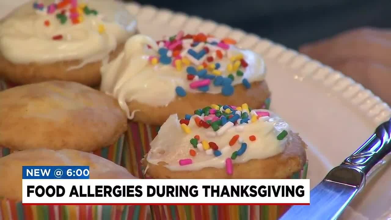 How parents can prepare food for kids with food allergies?