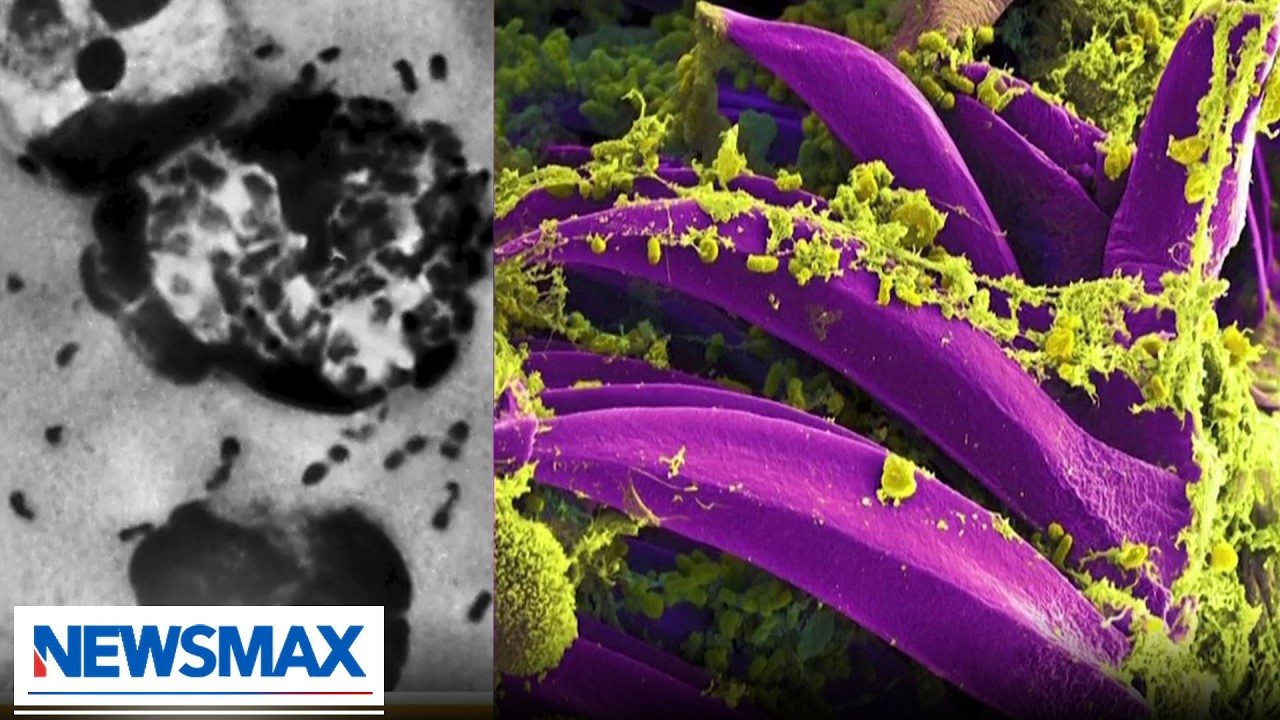 Doctor warns of Russian response to possible plague outbreak | Wake Up America Weekend