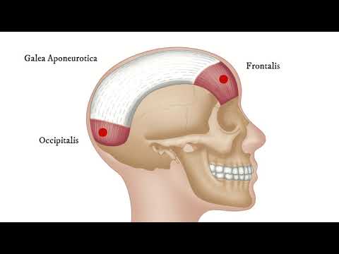 Epicranius - How To Find Trigger Points (for Headache)