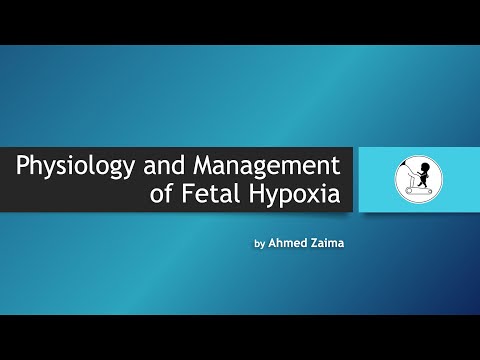 CTG Teaching 28 07 20 part 1 (Physiology and Management of Fetal Hypoxia - Advanced)
