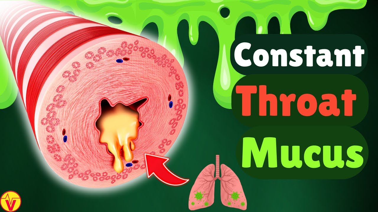 6 Real Causes of Phlegm & Mucus in Your Throat: Stop Constant Throat Clearing | VisitJoy