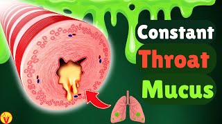 6 Real Causes of Phlegm & Mucus in Your Throat: Stop Constant Throat Clearing | VisitJoy