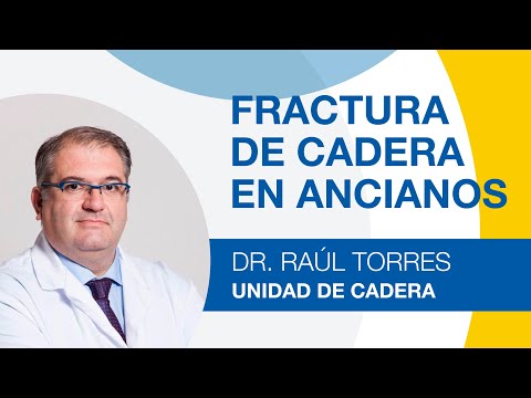 Hip Fractures in the Elderly and Older Adults