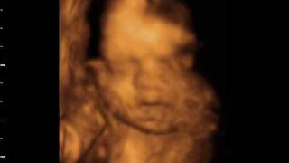 lisa and allen window to the womb