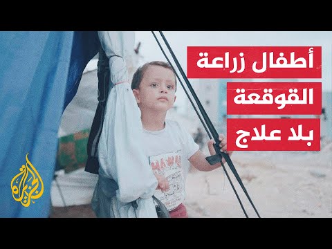 فيديو | عامان من الحرب والدمار يهددان حياة أطفال زراعة القوقعة في غزة