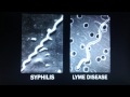 Under Our Skin Dr McDonald Clip Lyme Disease Alzhemer S MS