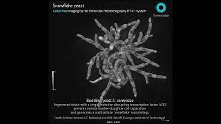 Snowflake yeast - Label-free live cell imaging