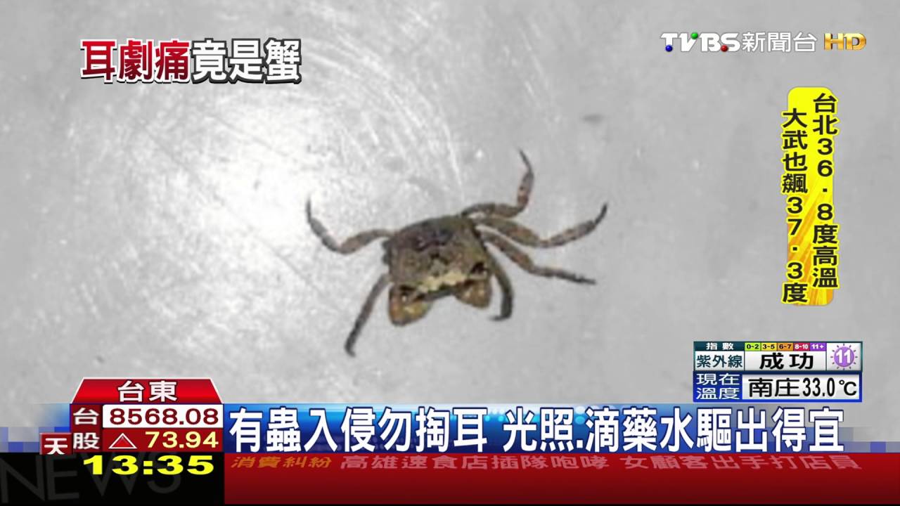 誇張!男半夜耳痛難耐 竟是「小螃蟹」侵入