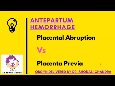 Placental Abruption Vs Placenta Previa : Clinical Scenario : Dr. Shonali Chandra #NEET PG, #AIIMS PG