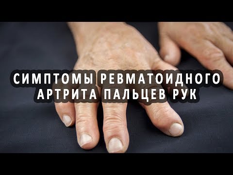 Мрт головного и шейного отдела Суставы верхних конечностей болят