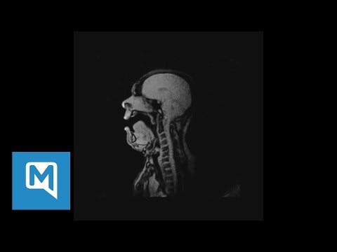 Vídeo de Youtube