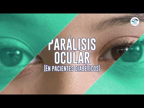 Ocular Paralysis Treatment for Diabetic Patients in Tijuana, Mexico