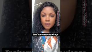 Comment traiter les tâches du visage #blogger  #skincare
