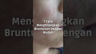 Download lagu 7 Cara Menghilangkan Bruntusan Dengan Mudah Dan Cepat mp3 Download lagu 7 Cara Menghilangkan Bruntusan Dengan Mudah Dan Cepat mp3