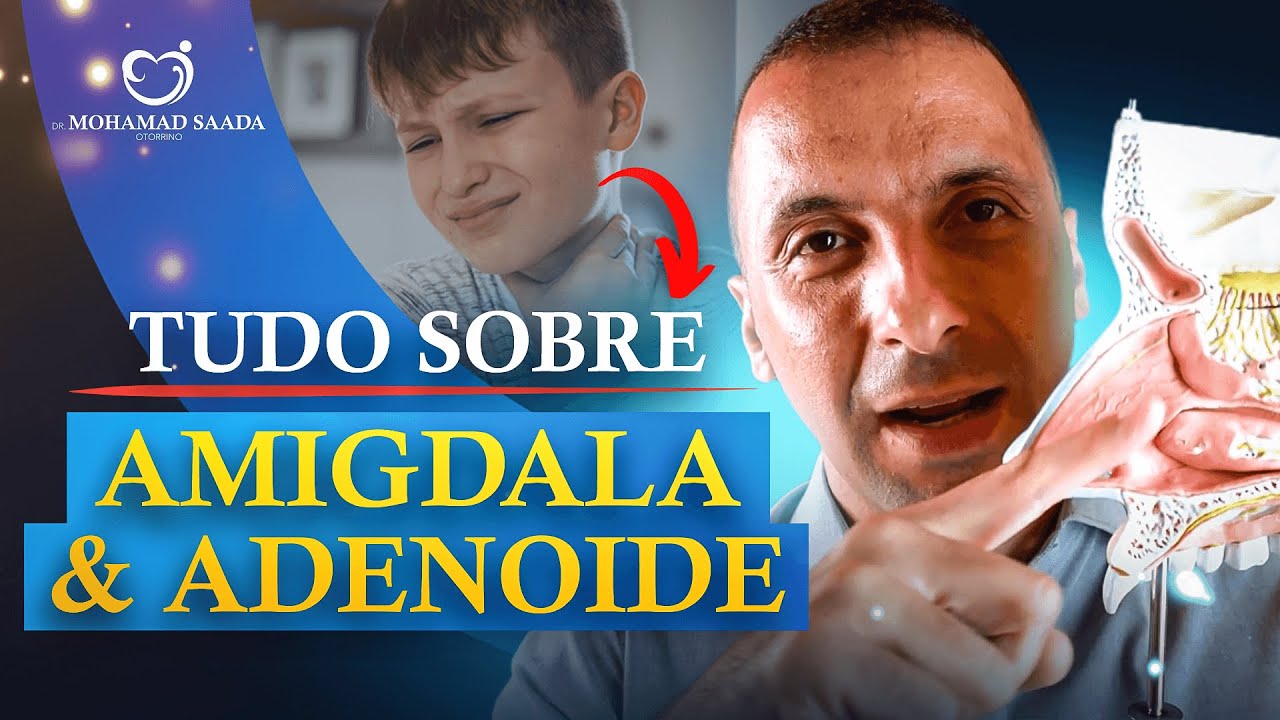TUDO SOBRE AMÍGDALA E ADENOIDE