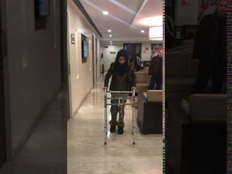 Giant Cell Tumor — Patient Video