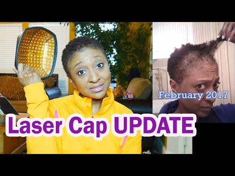 LASER CAP UPDATE - 3 YEARS LATER - TV Blake