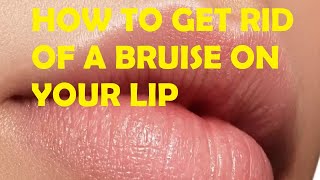 how to get rid of a bruise on your lip fast and easy