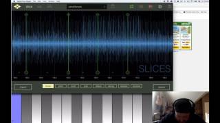 Reslice by Virsyn Fourtet Technique
