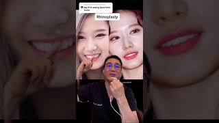 SANA PLASTIC SURGERY (comment which k-celeb will i post next)