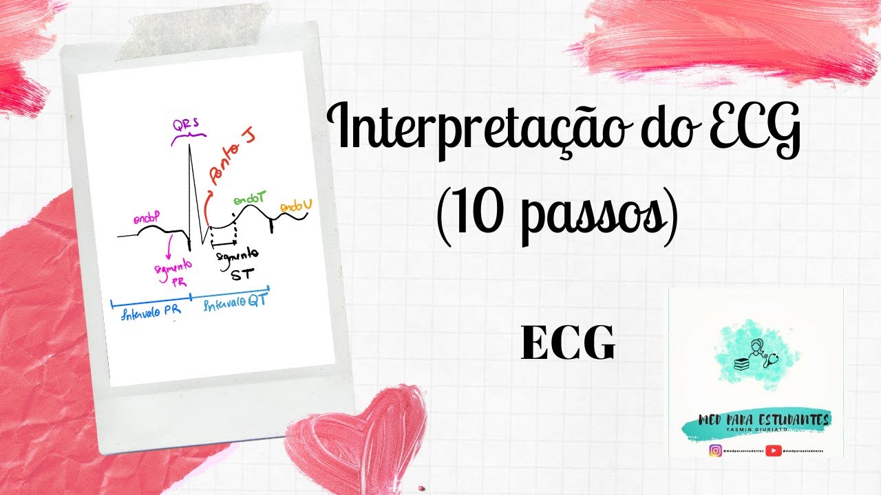 ECG - O papel do eletrocardiograma e sua interpretação (10 passos)