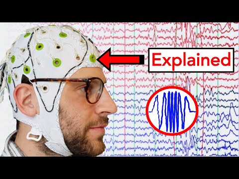 EEG (Electroencephalogram) Explained