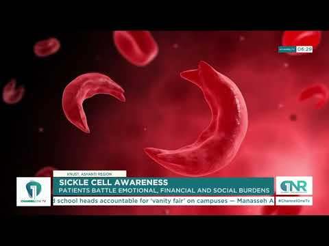 Living With Sickle Cell: The Hidden Struggles Beyond the Pain