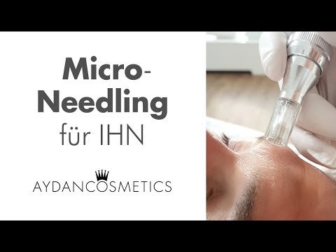 Micro-Needling für IHN ♕ AYDAN COSMETICS Straubing